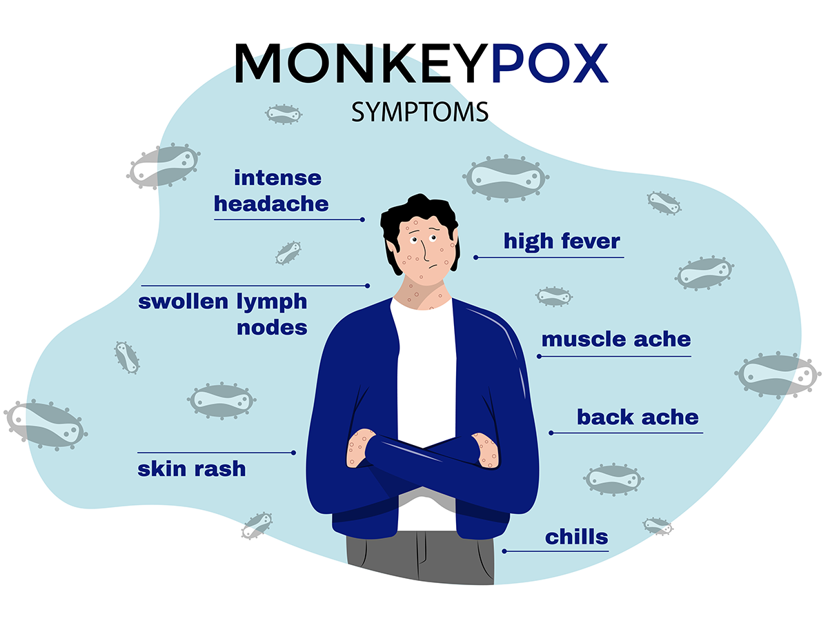 monkeypox