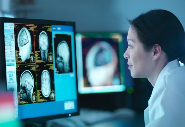 Doctor revisando escáneres cerebrales